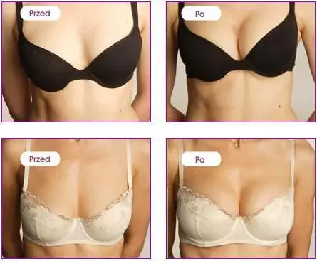 Perfect Bust стимулирующий гель – 150 мл Фото num