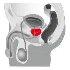 Prostate Joystick Anal Plug – Black — Photo 3