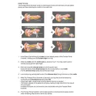 Pumped Extender Adjustable Anatomical System — Photo 7