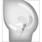 beau cœur Elorin набор тренировочных шариков любви Фото num