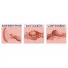 Haru Pleasure Device Soft Touch Anatomical Model – Compact Size — Photo 4