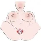 Intimate Spreader Lila Foto 9