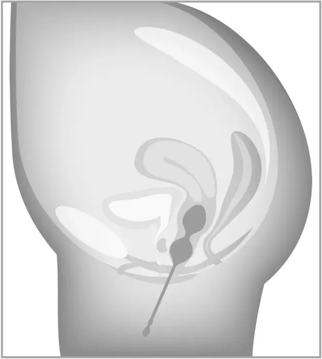 beau cœur Elorin набор тренировочных шариков любви Фото num